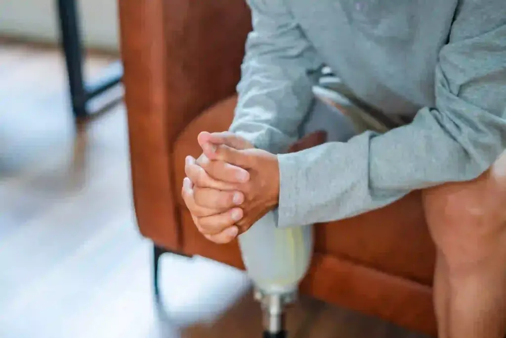 Seeking Damages for Limb Loss: Medical Expenses, Lost Wages, and Pain and Suffering | Florida | Call 407-481-0066 Seeking Damages for Limb Loss: Medical Expenses, Lost Wages, and Pain and Suffering | Florida | Call 407-481-0066